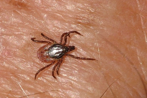 Pioneer Highland project to make Lyme disease diagnosis easier