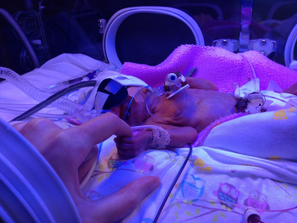 Oban opticians help raise &pound;73k for premature and sick babies