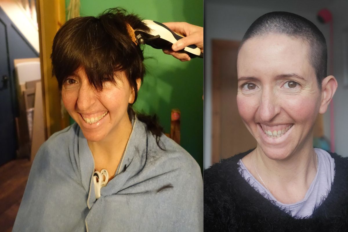 Fort William mum of two faces cancer treatment head on