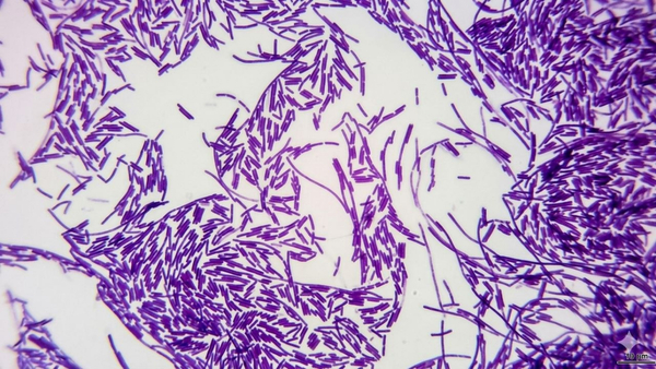 Probiotics in aquaculture