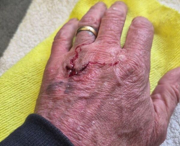 Man charged by police after XL Bully 'attacks grandfather'